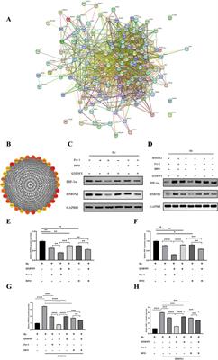 Qingxuan Runmu Yin alleviates dry eye disease via inhibition of the HMOX1/HIF-1 pathway affecting ferroptosis